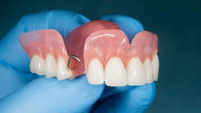 酶制劑——口腔健康守護(hù)者